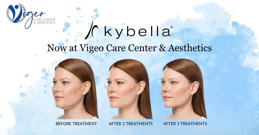 Kybella is now available at Vigeo Care Center & Aesthetics banner