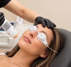 Vigeo Aesthetics Services - Aerolase Laser Services